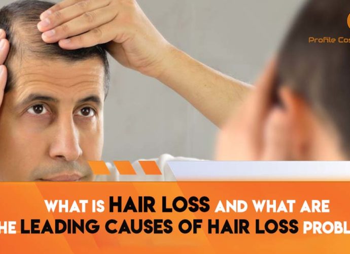 Dandruff A Cause Of Hair Loss