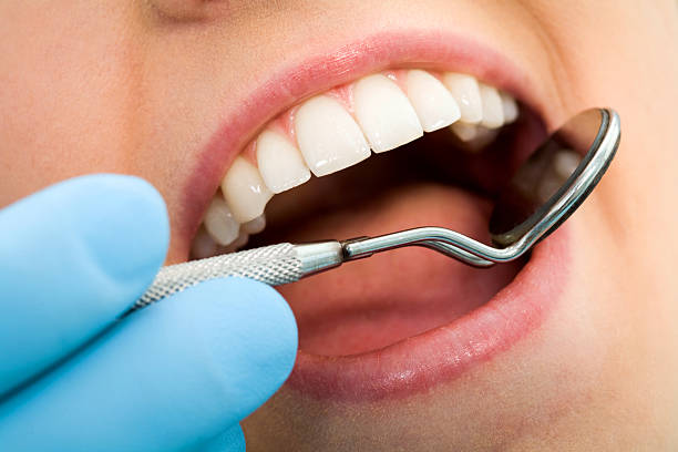 The 5 things you need to know about dental fillings